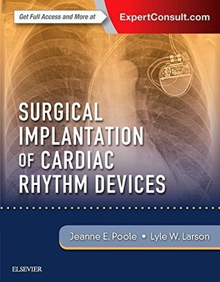 Download Surgical Implantation of Cardiac Rhythm Devices - Jeanne Poole file in PDF
