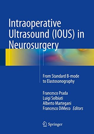 Full Download Intraoperative Ultrasound (IOUS) in Neurosurgery: From Standard B-mode to Elastosonography - Francesco Prada file in PDF