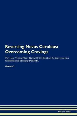 Read Online Reversing Nevus Ceruleus: Overcoming Cravings The Raw Vegan Plant-Based Detoxification & Regeneration Workbook for Healing Patients.Volume 3 - Health Central | PDF